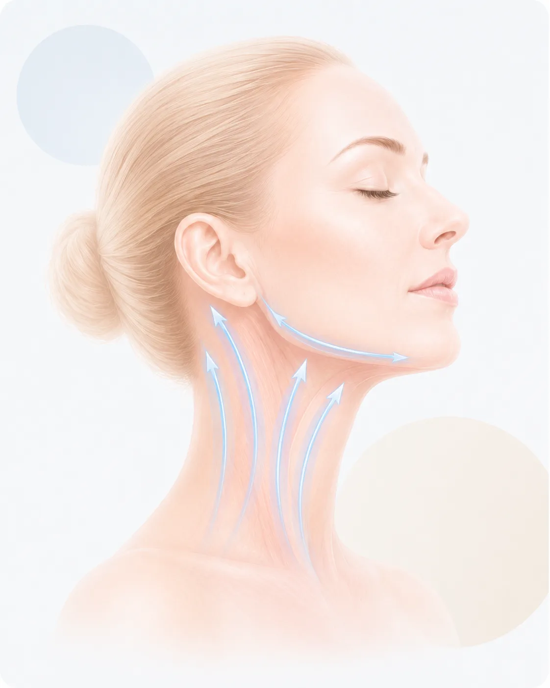 Neck Lift